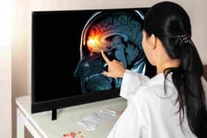 Fishers traumatic brain injury lawyer