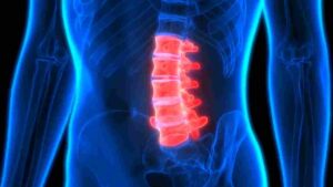 Lebanon spinal cord injury attorney