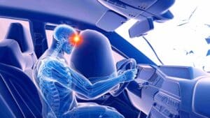 TBI lawyer in Beech Grove, IN